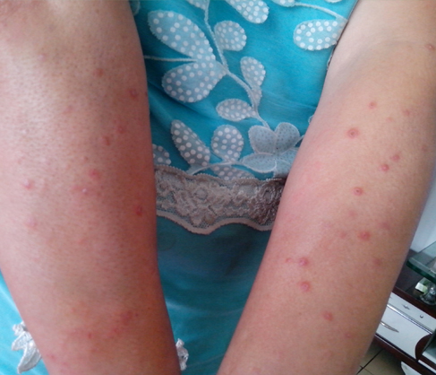 �t(y��)�����L�ƶ�